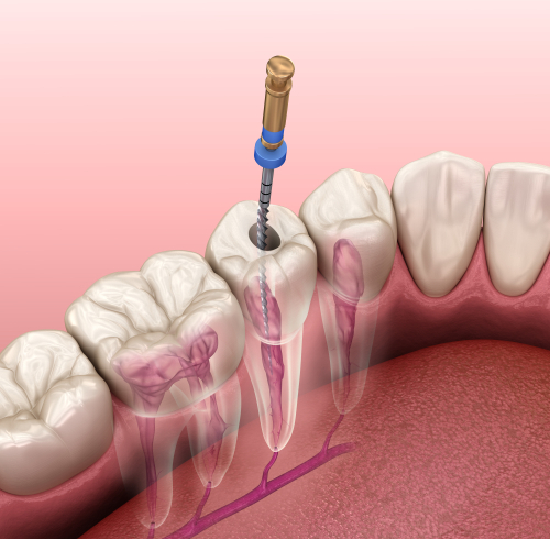 Endodontie